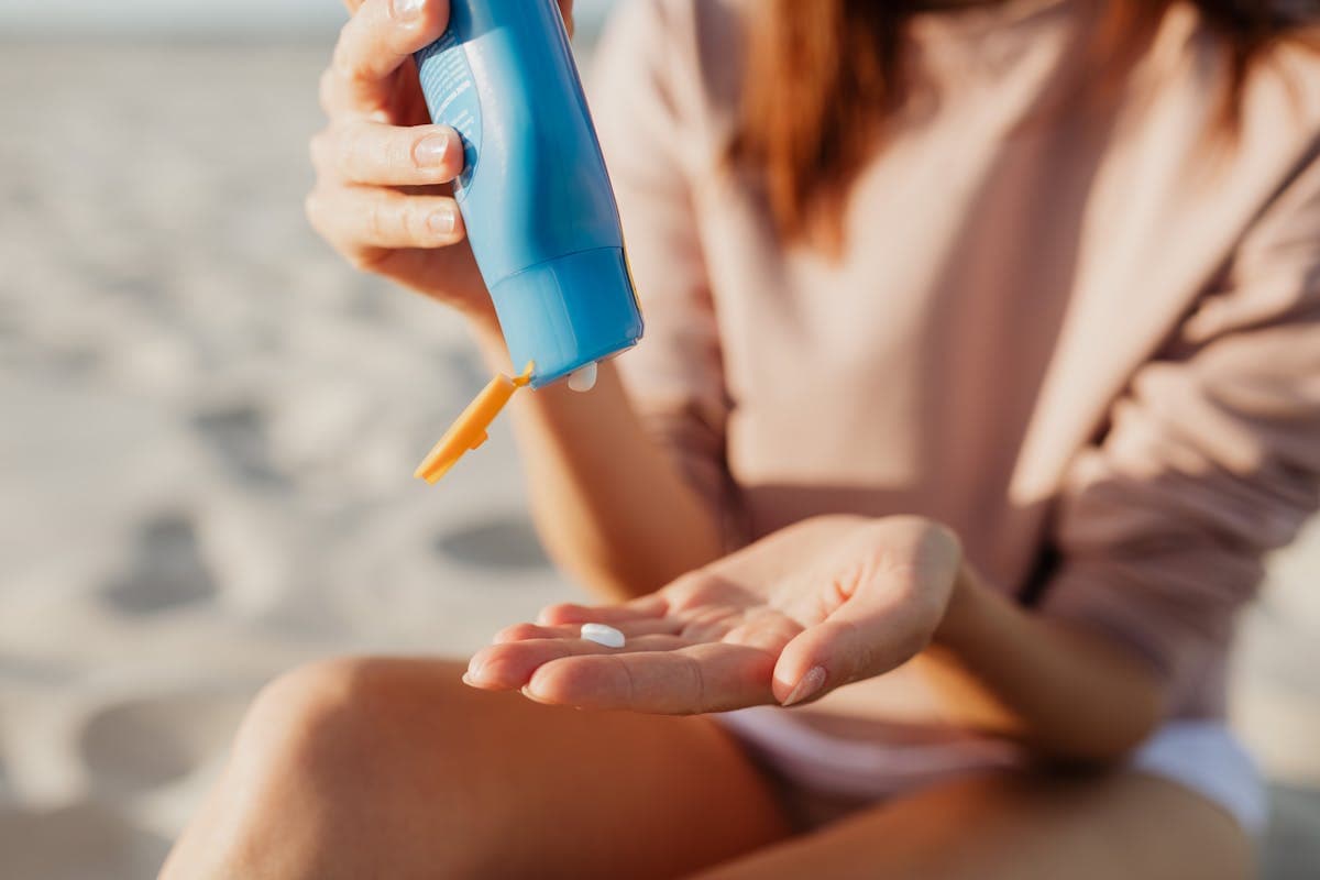 Sunburn: First Aid and What Not to Do